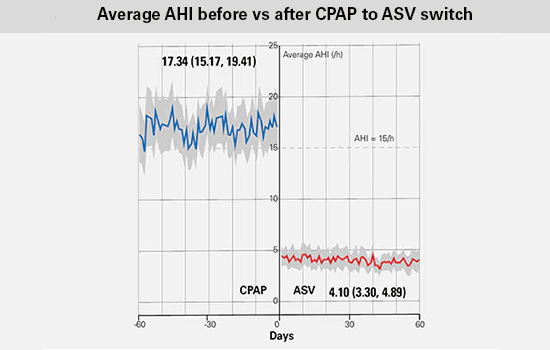 ASV-massadata: ylipainehoidon käyttötunnit ennen CPAP-hoidosta ASV-hoitoon siirtymistä ja siirtymisen jälkeen