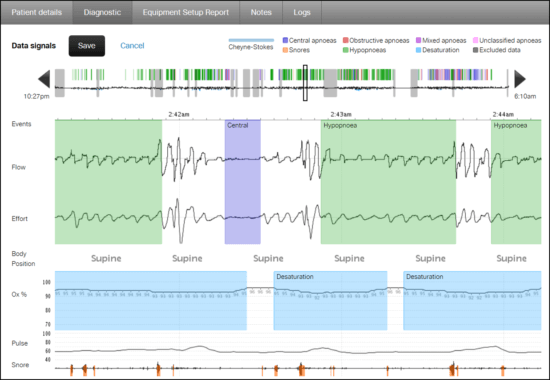 apnealink-air-diagnostic-report-resmed