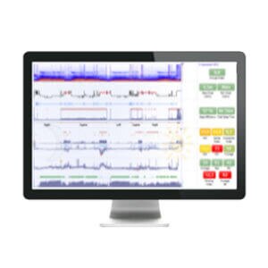 noxturnal-software-homepage-resmed