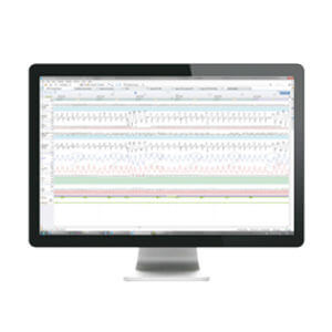 noxturnal-software-results-resmed