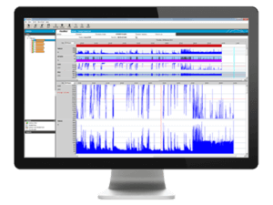 ResScan patient therapy management software ResMed