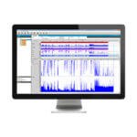resscan-potilastietojen-hallintaohjelmisto-tulokset-resmed