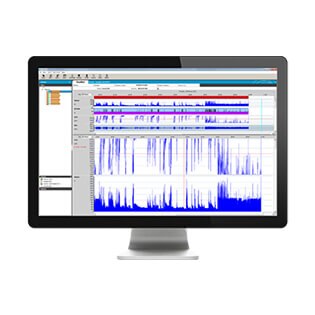 resscan-potilastietojen-hallintaohjelmisto-tulokset-resmed